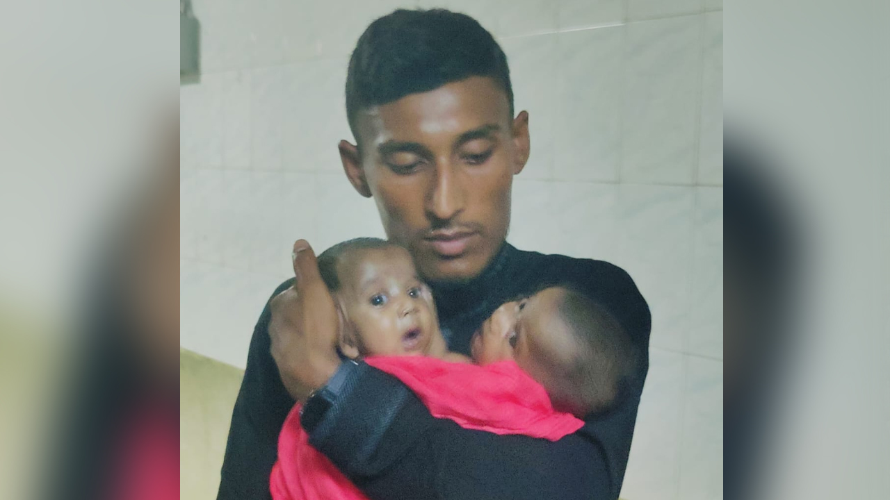 জোড়া লাগা দুই শিশুর চিকিৎসার দায়িত্ব নিল সরকার