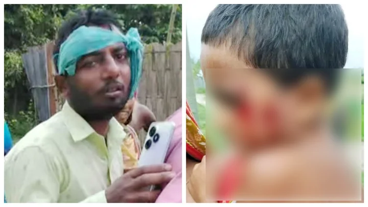 গাইবান্ধায় মানুষকে কামড়ানো শিয়াল-কুকুরের নমুনায় মিলল র্যাবিস ভাইরাস