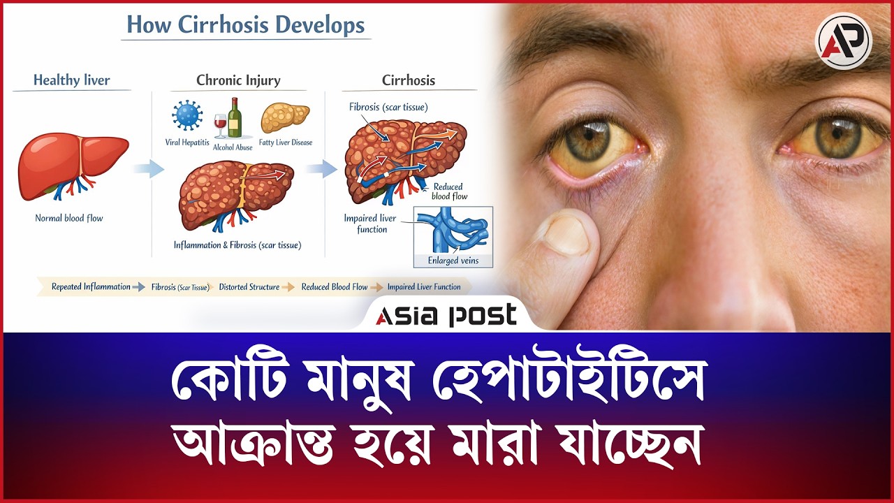 বাংলাদেশের কোটি মানুষ নিজের অজান্তেই হেপাটাইটিসে আক্রান্ত হয়ে মারা যাচ্ছেন