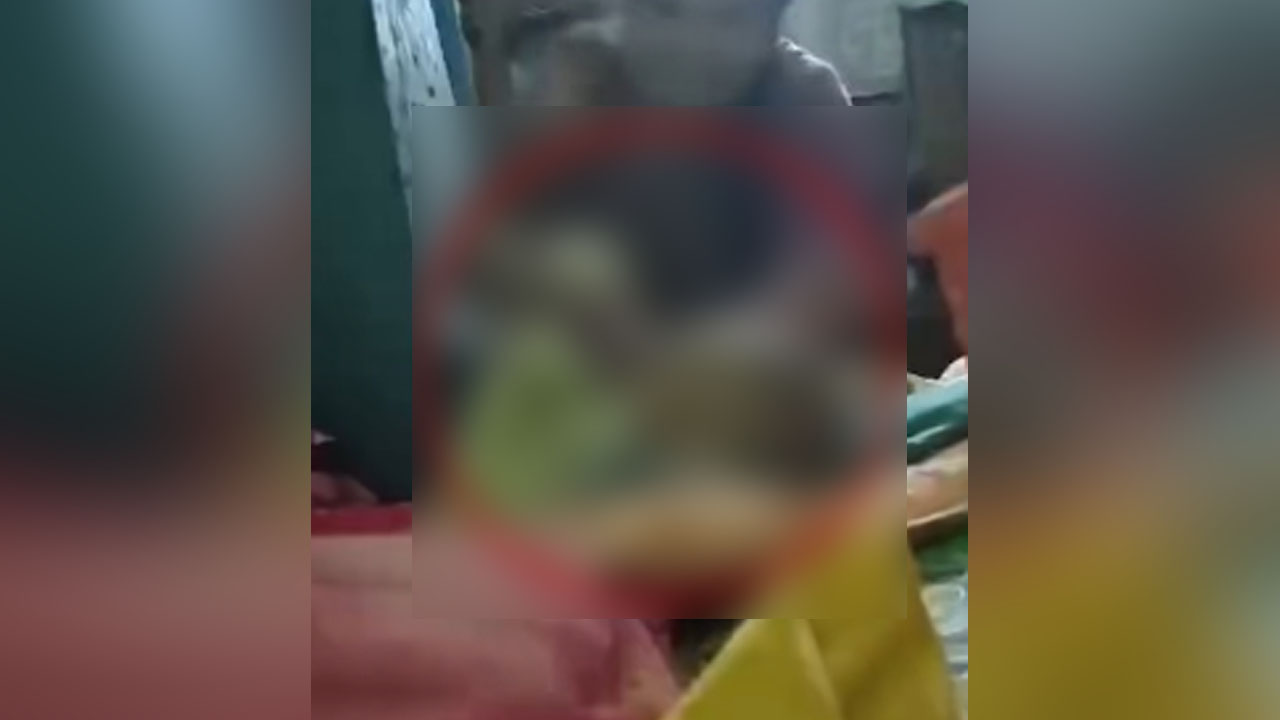 দুই মাসের ঘুমন্ত শিশুর পা মুচড়ে ভাঙলেন চাচি