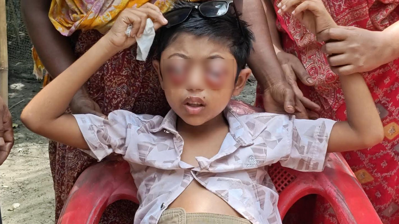 ক্যানসার কেড়ে নিয়েছে দুই চোখ, বাঁচতে চায় জুনায়েদ 