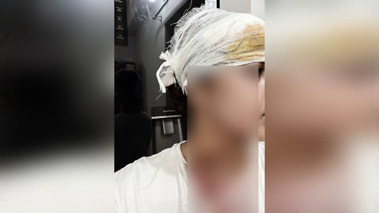 কুমিল্লায় জবি ছাত্রীকে কুপিয়ে হত্যাচেষ্টা