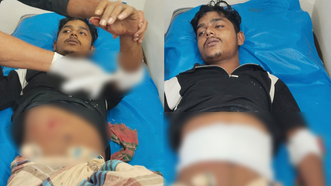 ফ্রি ফায়ার খেলাকে কেন্দ্র করে যুবককে ছুরিকাঘাত