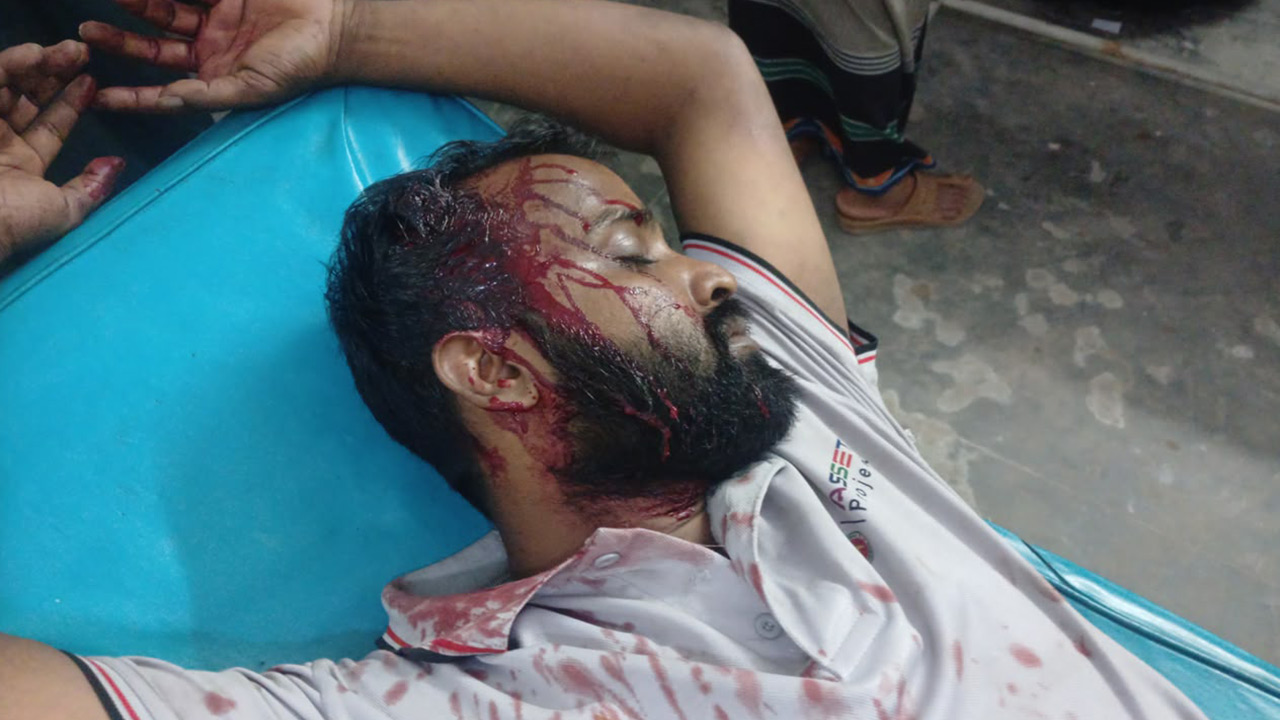 হাতুড়ি পেটায় মাথা ফেটে যায় ইয়াহিয়া ওরফে আল আমিনের। ছবি: এশিয়া পোস্ট