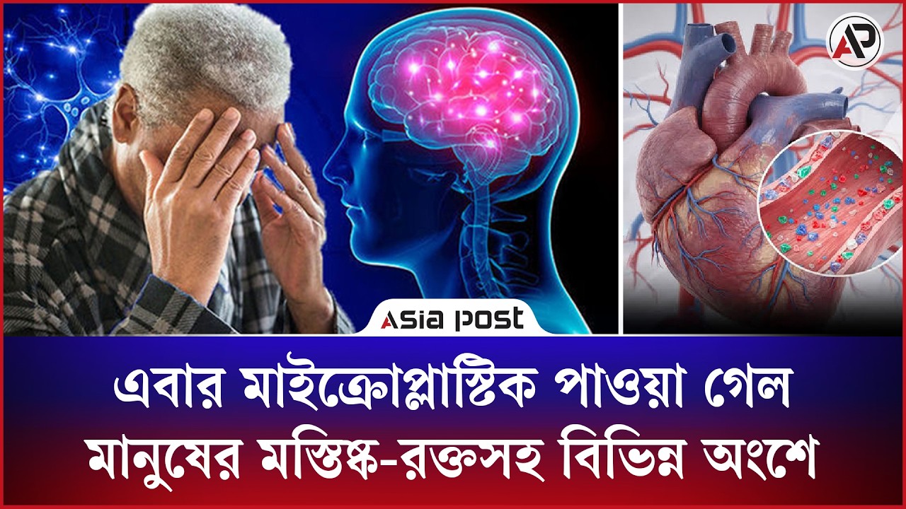 এবার মাইক্রোপ্লাস্টিক পাওয়া গেল মানুষের মস্তিষ্ক-রক্তসহ বিভিন্ন অংশে