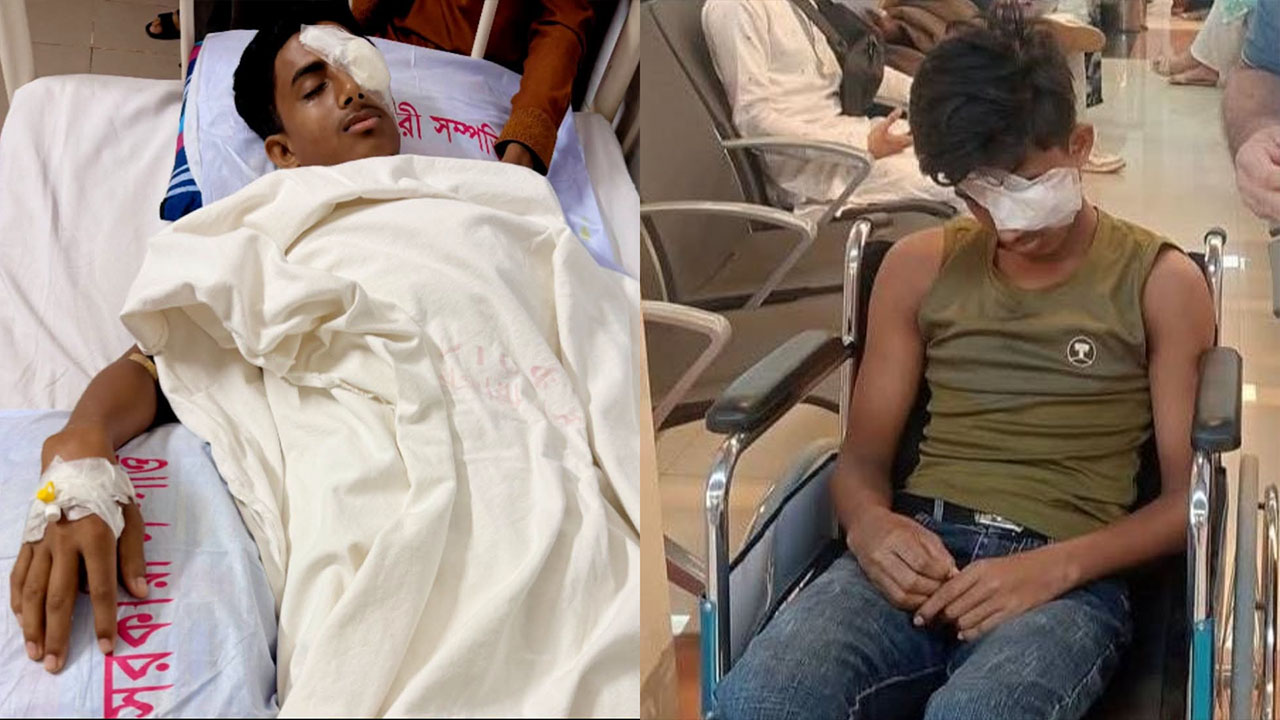 রাজনৈতিক সংঘর্ষে দৃষ্টিশক্তি হারিয়ে অনিশ্চিত ভবিষ্যৎ