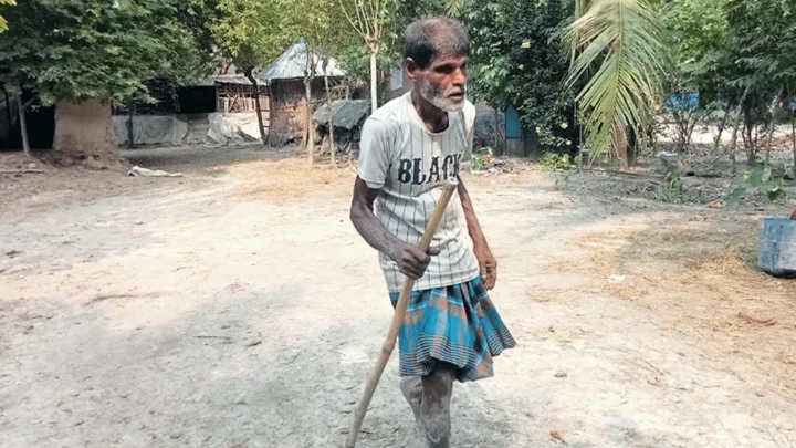 দেখা হয়নি পৃথিবীর রূপ-রং, তবুও আঁধার জয় করে আলো ছড়াচ্ছেন চিত্তরঞ্জন