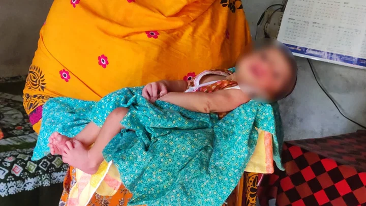 ২৮ আঙুল নিয়ে শিশুর জন্ম, একনজর দেখতে ভিড়
