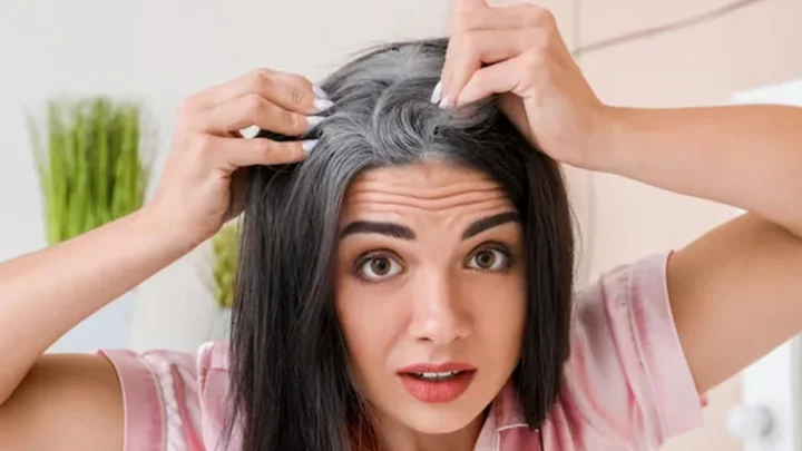 কম বয়সেই চুল পেকে যাচ্ছে, জানুন সমাধান