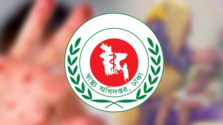 হামের উপসর্গে আরও ৭ জনের মৃত্যু