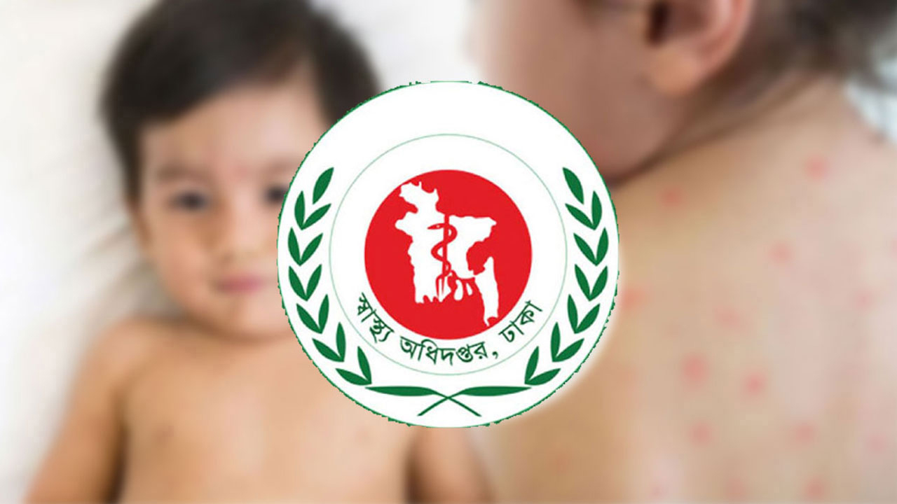 হাম ও উপসর্গে আরও ৫ শিশুর মৃত্যু