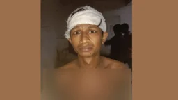 প্রতিমন্ত্রী ববি হাজ্জাজের লোকজনের বিরুদ্ধে যুবকের মাথা ফাটানোর অভিযোগ