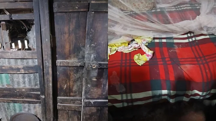গৃহবধূর কামড়ে আঙুল হারাল চোর