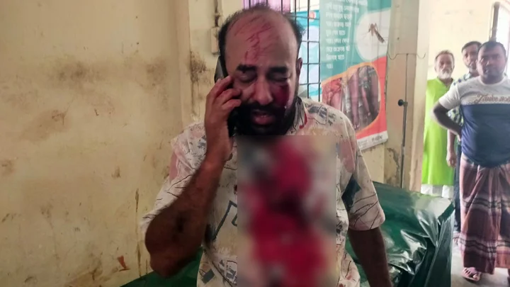 কুষ্টিয়ায় সংবাদ সংগ্রহে গিয়ে এমপির স্বজনদের মারধরের শিকার সাংবাদিক