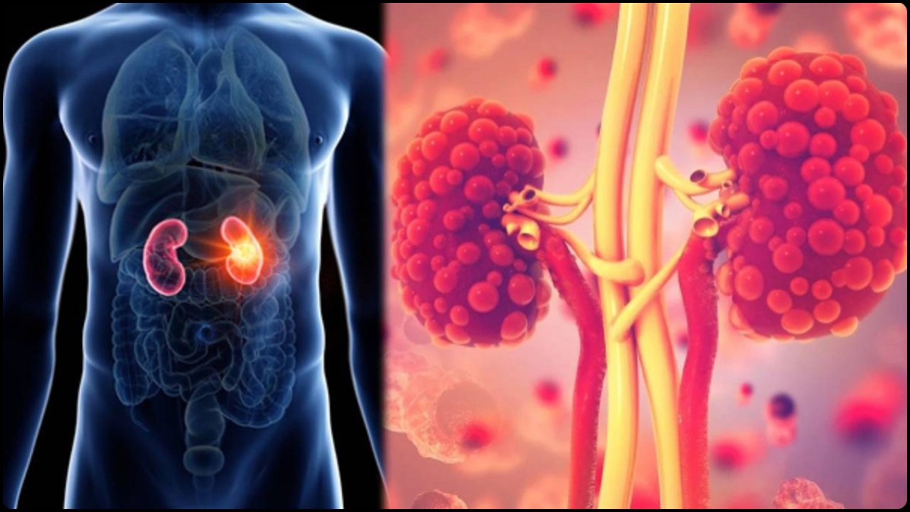 kidney