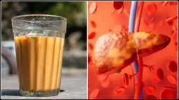 ফ্যাটি লিভার ধরা পড়লে দুধ-চা নিয়ে যা জানা জরুরি 
