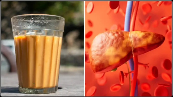 ফ্যাটি লিভার ধরা পড়লে দুধ-চা নিয়ে যা জানা জরুরি