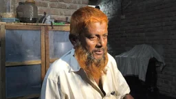 হাসপাতাল ছেড়ে নার্সের বাড়িতে চিকিৎসা, হাত হারানোর শঙ্কায় কৃষক