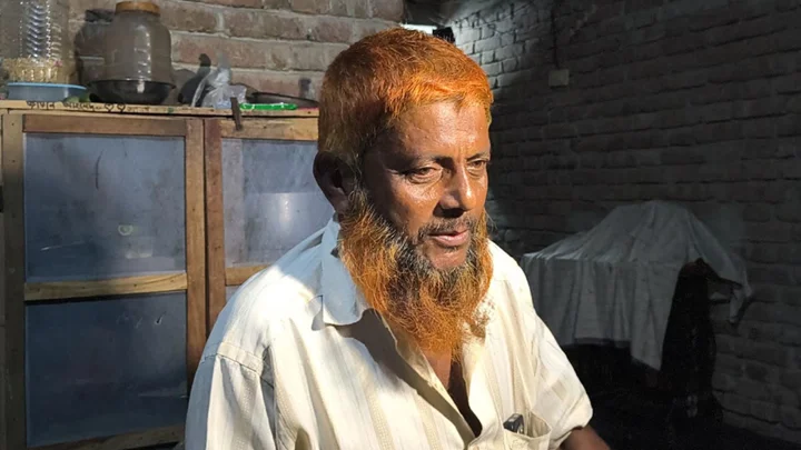 হাসপাতাল ছেড়ে নার্সের বাড়িতে চিকিৎসা, হাত হারানোর শঙ্কায় কৃষক