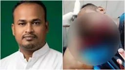 ‘কত টাকায় পদ বেচলেন’ বলা স্বেচ্ছাসেবক দল নেতাকে কুপিয়ে জখম-গুলি