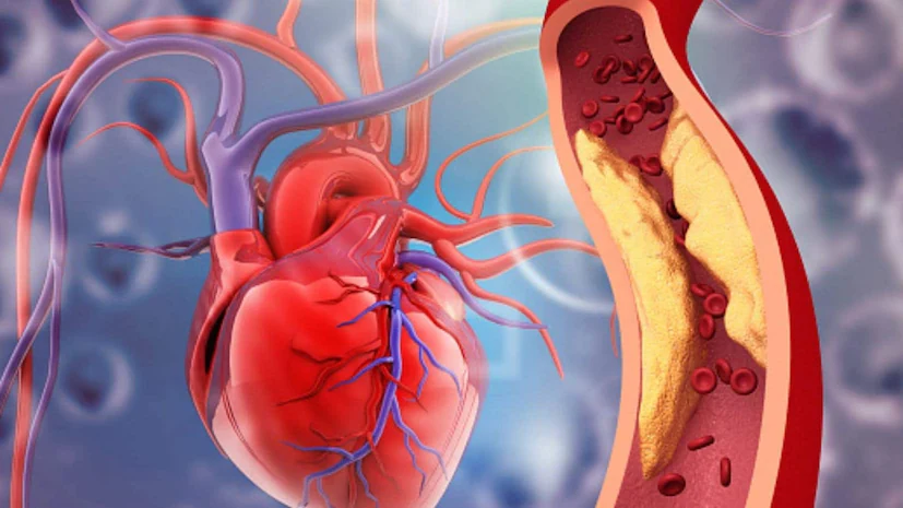 Drug abuse threatens young hearts, fuels rise in early heart attacks