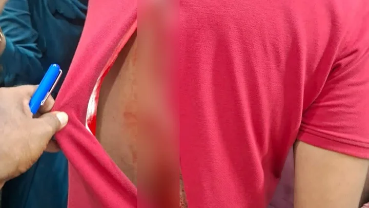 মোহাম্মদপুরে পুলিশকে ছুরিকাঘাত, পিঠে ৪৩ সেলাই