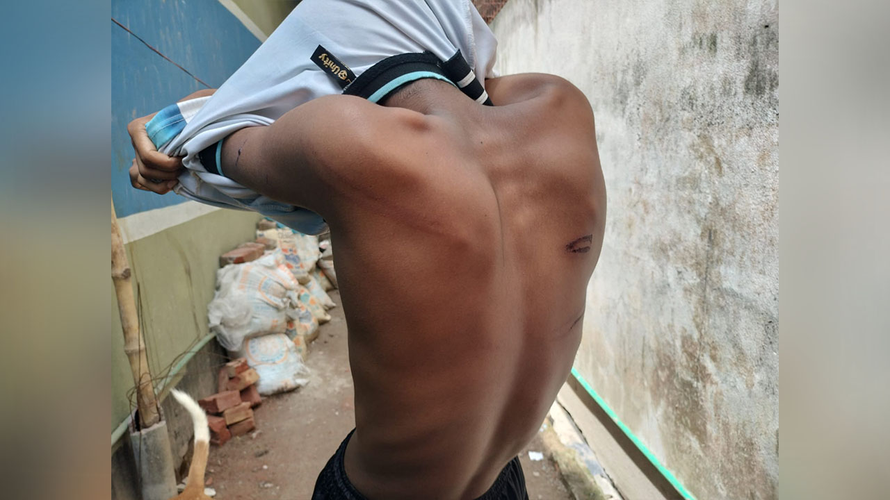 ইমো কলে মাদ্রাসা শিক্ষার্থীর বাঁচার আকুতিতে ছুটে আসে পরিবার