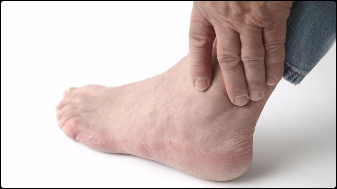 uric acid